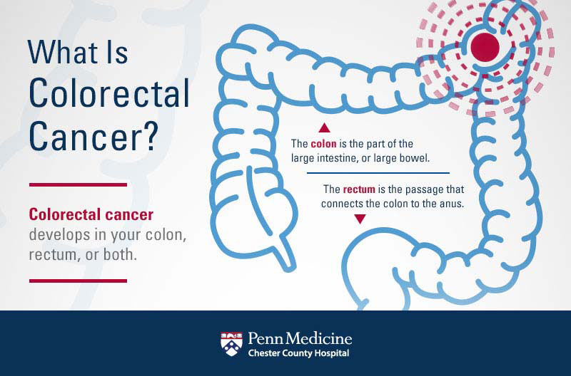 March Is National Colorectal Cancer Awareness Month Chester County