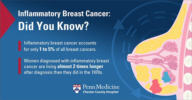 Inflammatory Breast Cancer: The Subtle Form of Breast Cancer - Chester  County Hospital