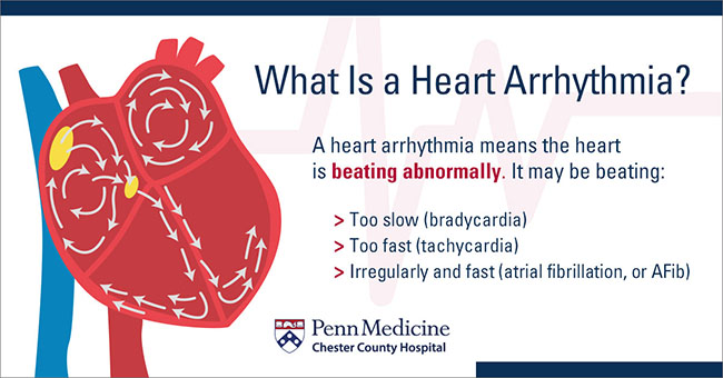 Arrhythmias in Children: Causes, Symptoms & Management