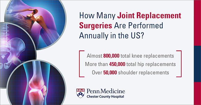 How the Same Day Discharge Program Is Transforming Total Joint Replacement  - Penn Medicine