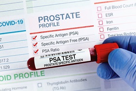 Prostate PSA Test