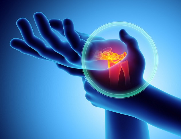 Carpal Tunnel Syndrome Symptoms - Chester County Hospital