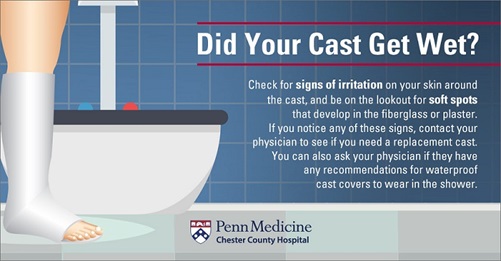 cast care 101 10 tips for surviving