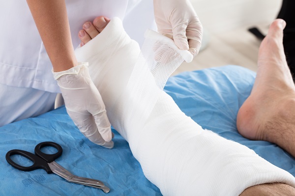 Cast For a Broke Bone: What Is It Made Of?