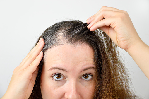 Why Some Women Have Gray Hair Earlier - Chester County Hospital