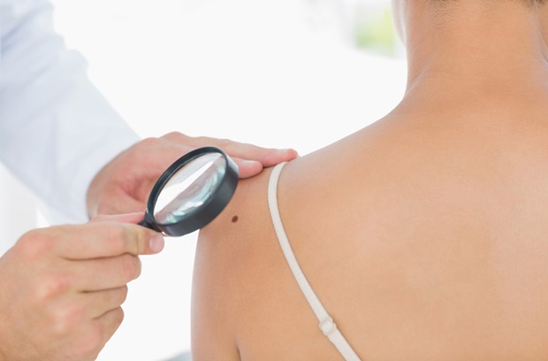 Dermatologist inspecting patient's shoulder with a magnifying glass
